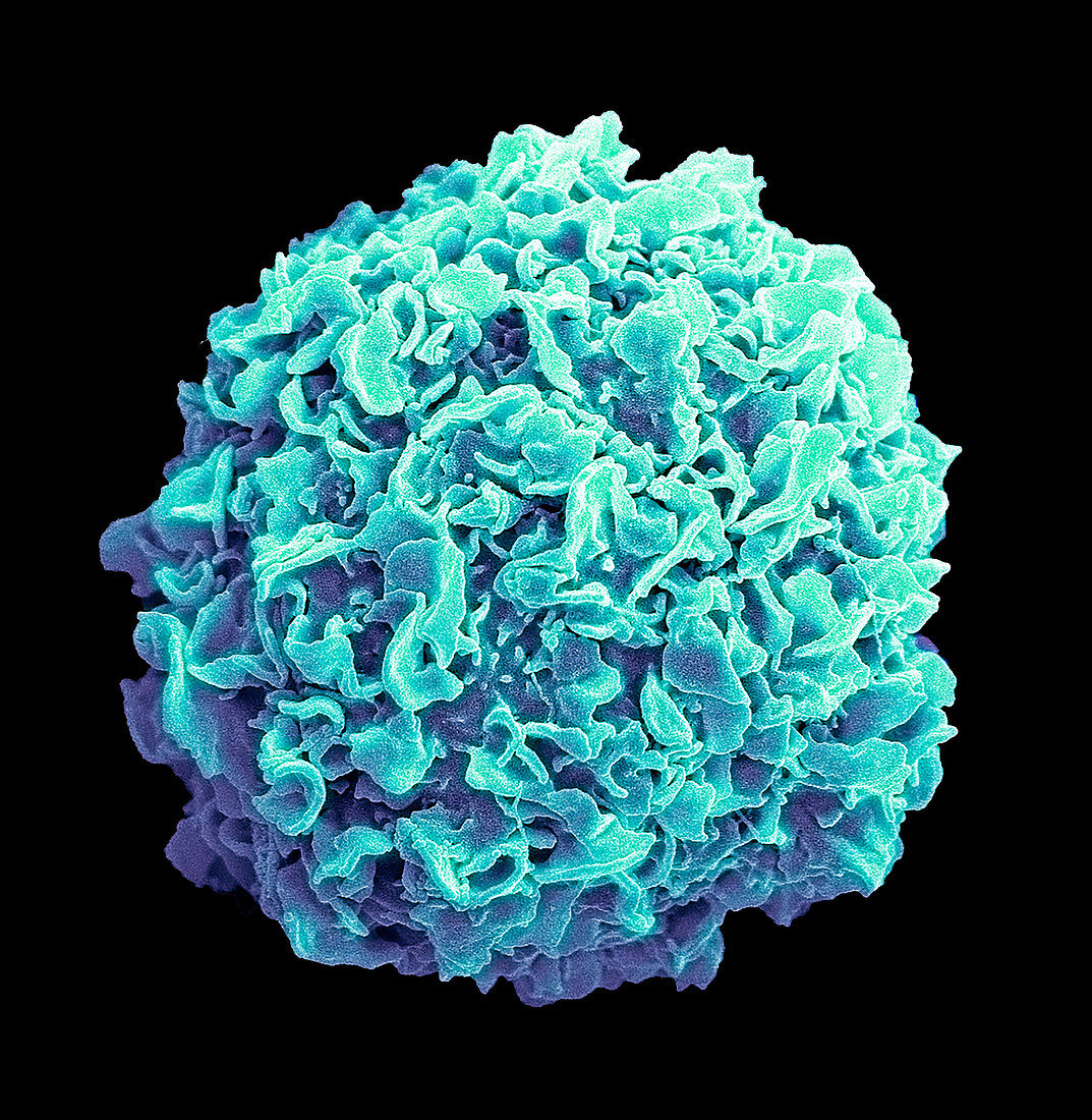 Breast cancer cell, SEM