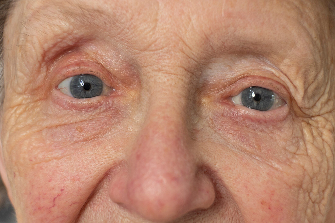 Senior woman's eyes
