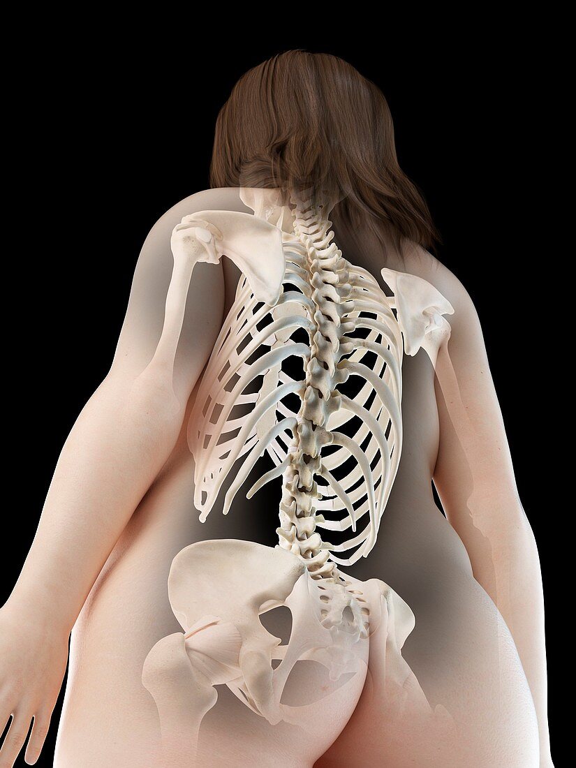 Back bones, illustration