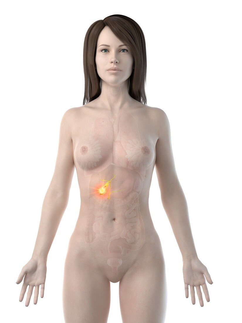 Gallbladder cancer, conceptual computer illustration