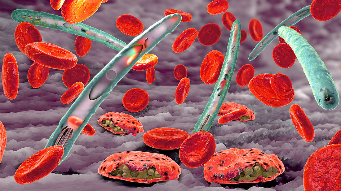 Malaria infection, illustration