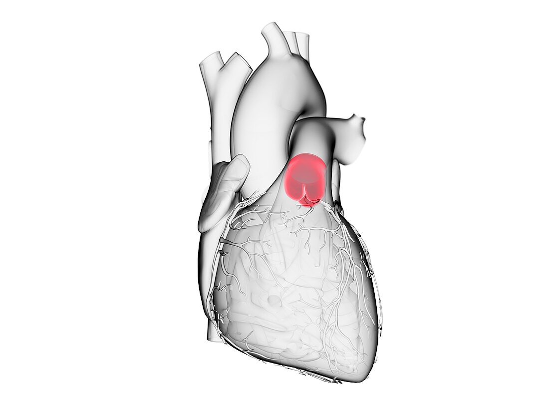 Pulmonary valve, illustration