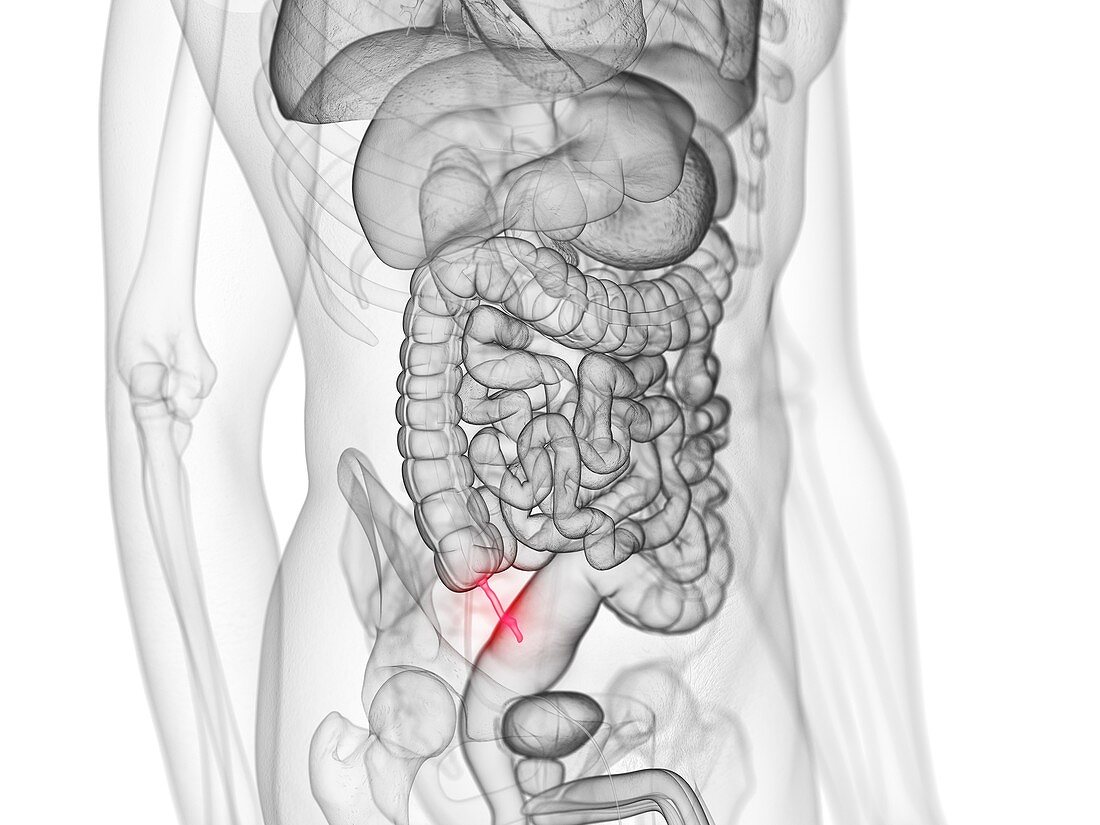 Appendix, illustration
