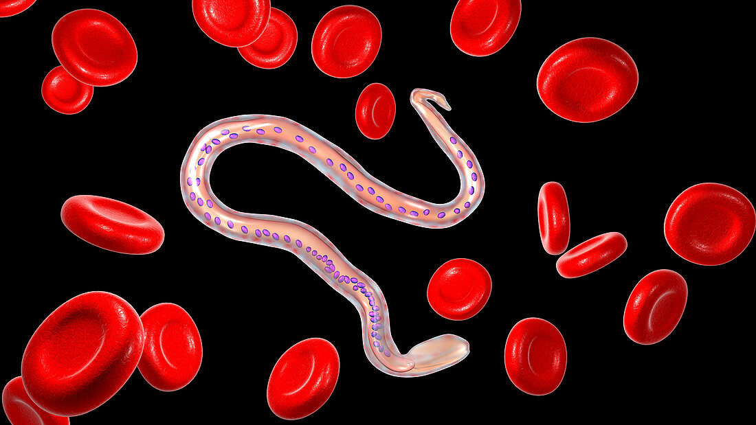 Wuchereria bancrofti parasite, illustration