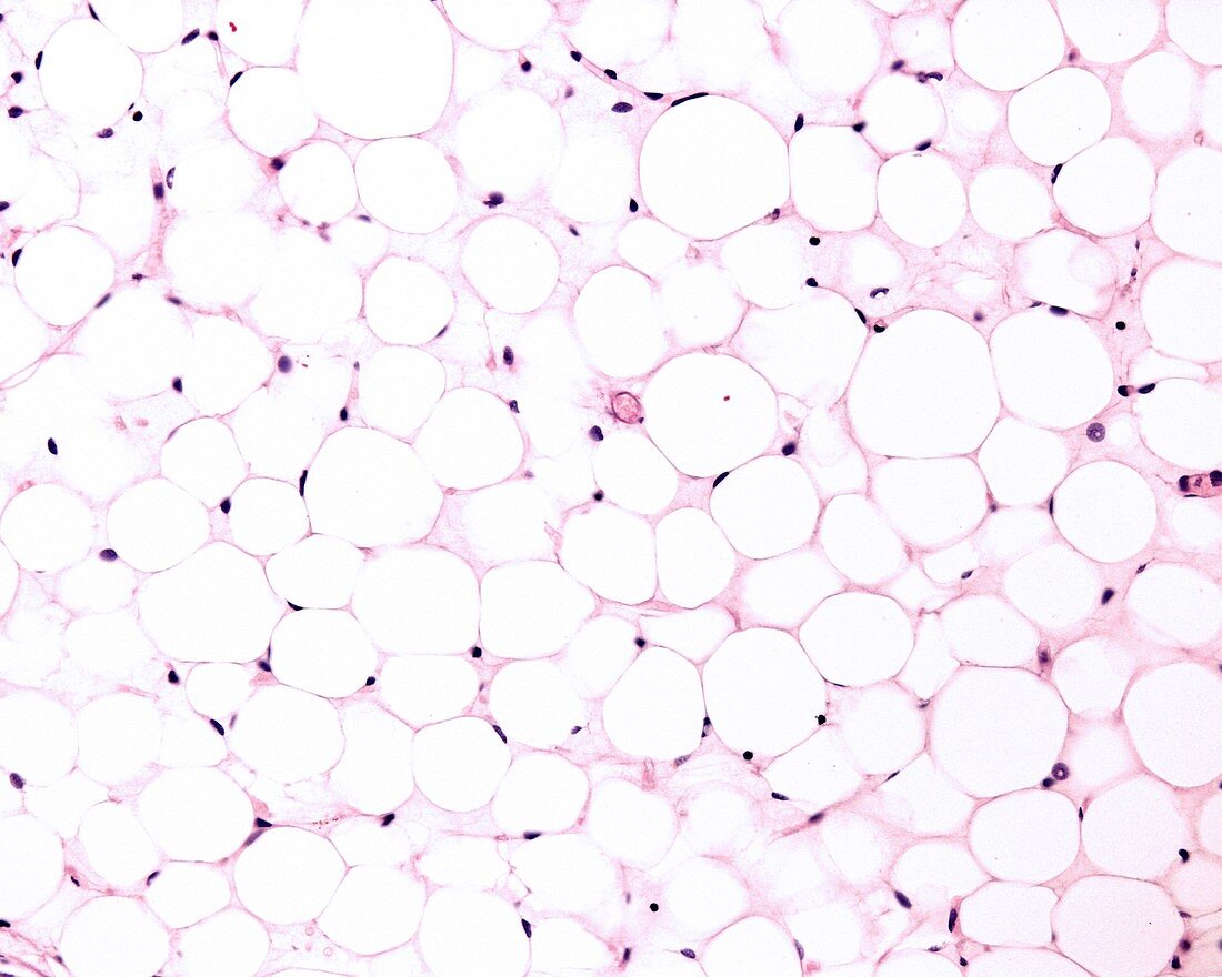 Adipocytes,light micrograph