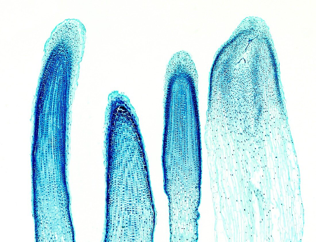 Mitosis in onion root tips,light micrograph