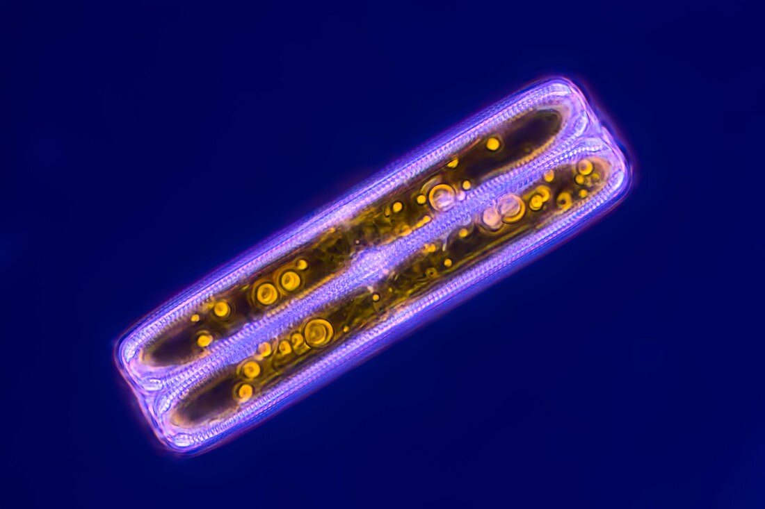 Diatom, light micrograph