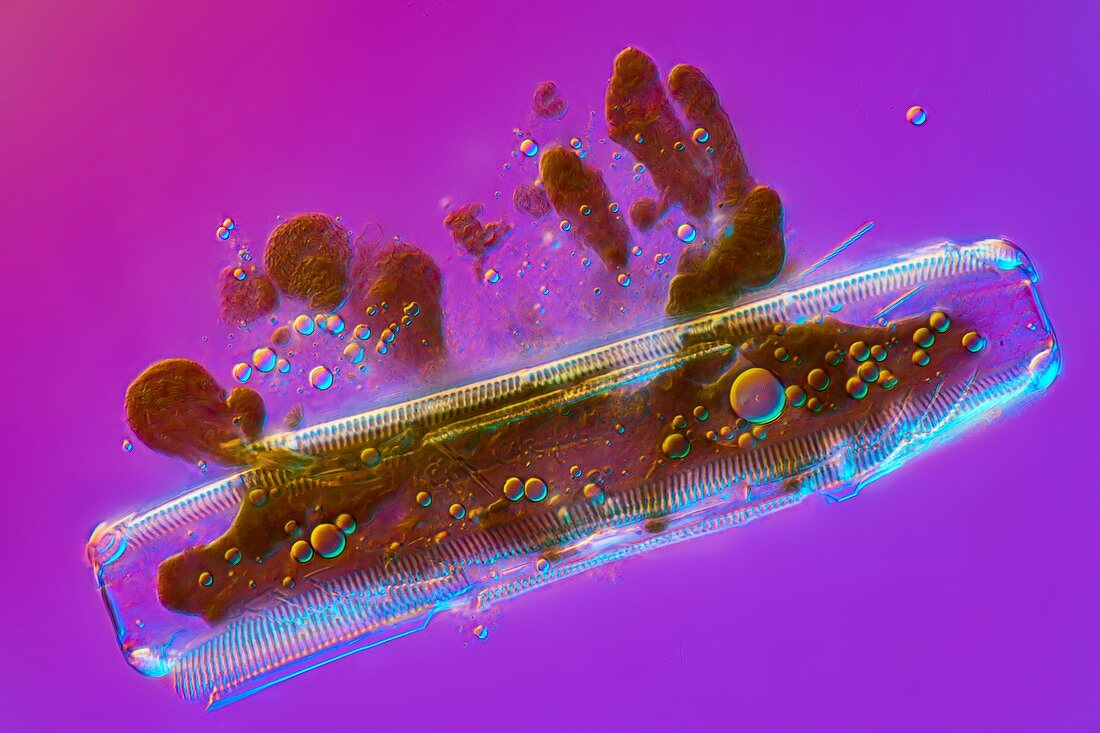 Diatom, light micrograph