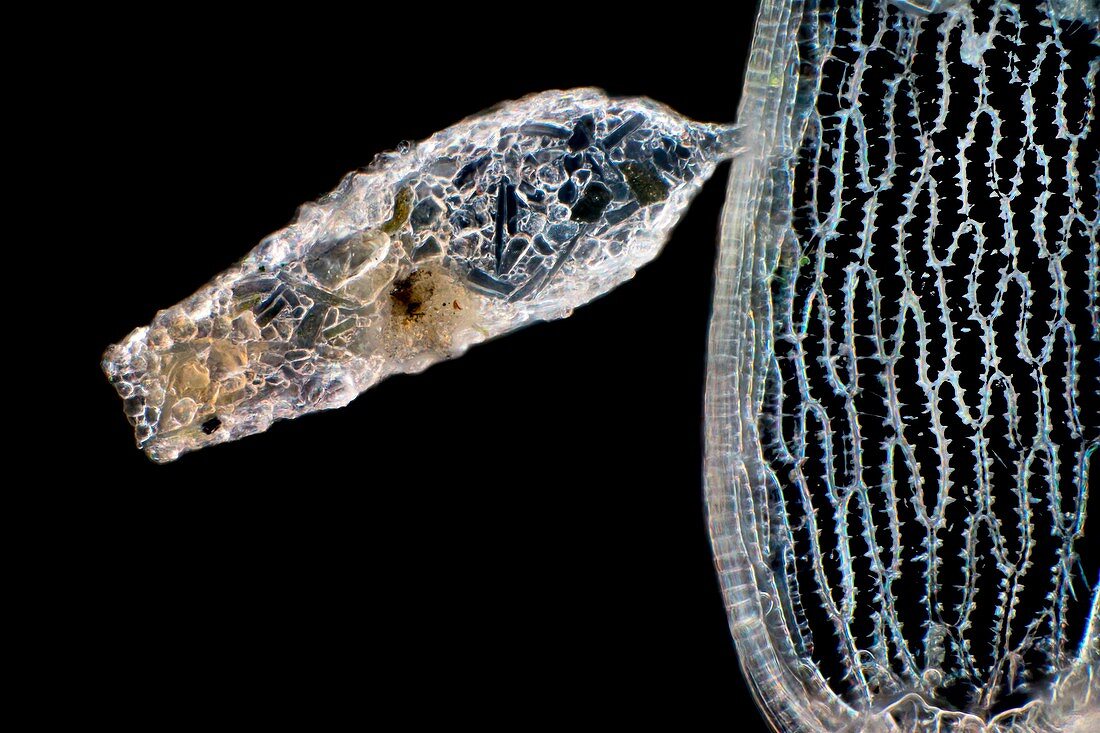 Shelled amoeba, light micrograph