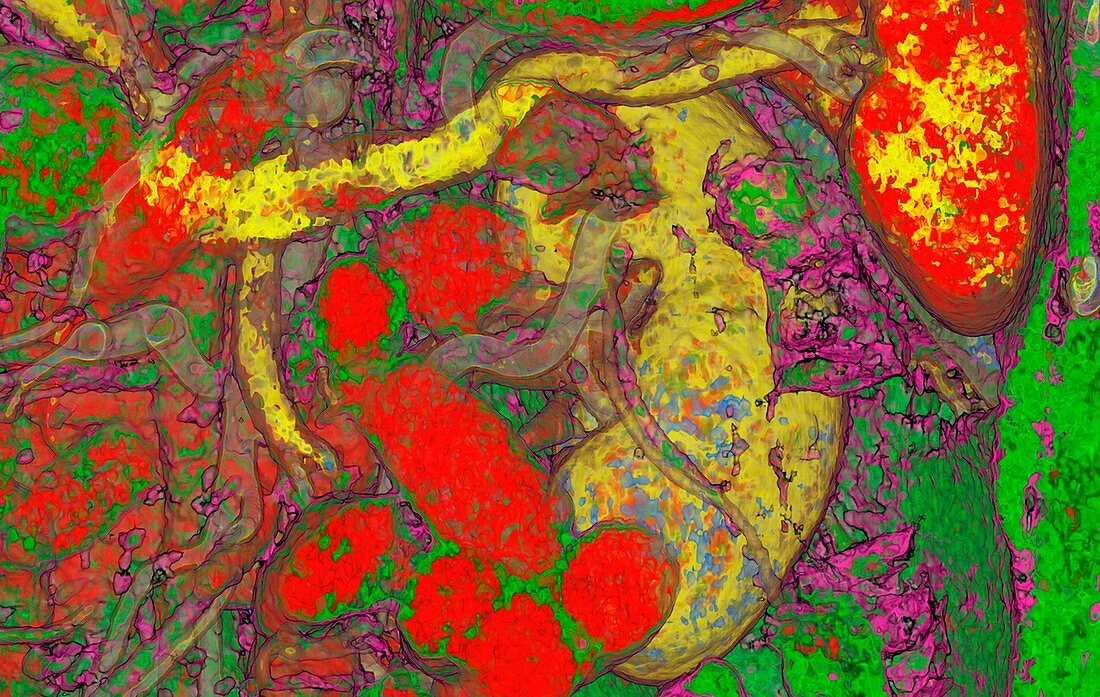 Abdominal organs,coloured CT scan