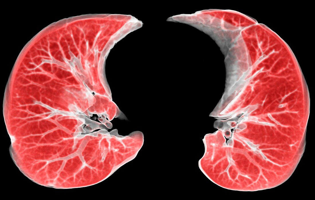 Human lungs,3D CT scan