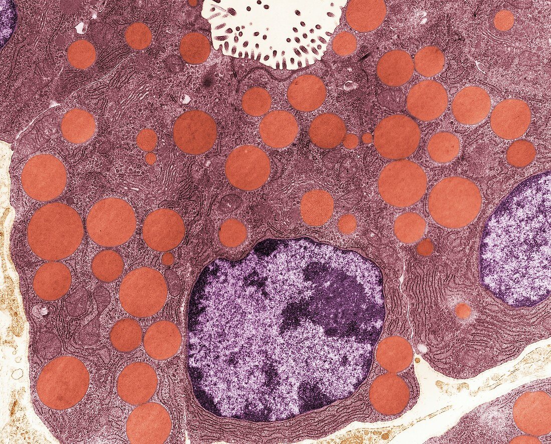 Pancreas tissue,TEM