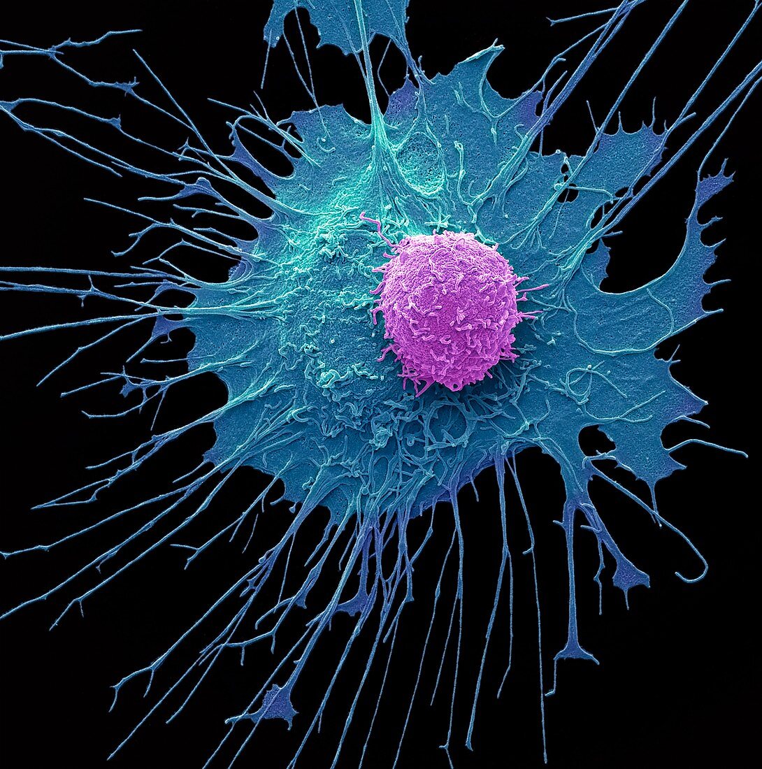 CAR T-cell therapy,SEM