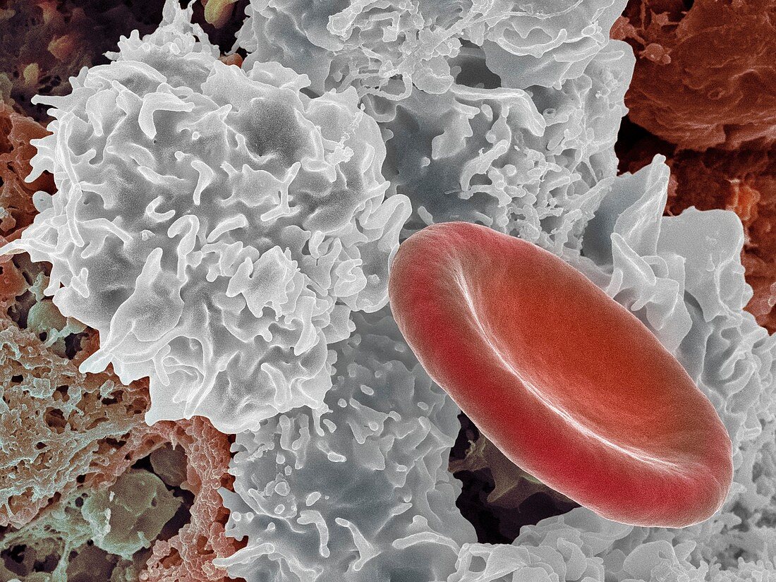 Tissue macrophage and red blood cell,SEM