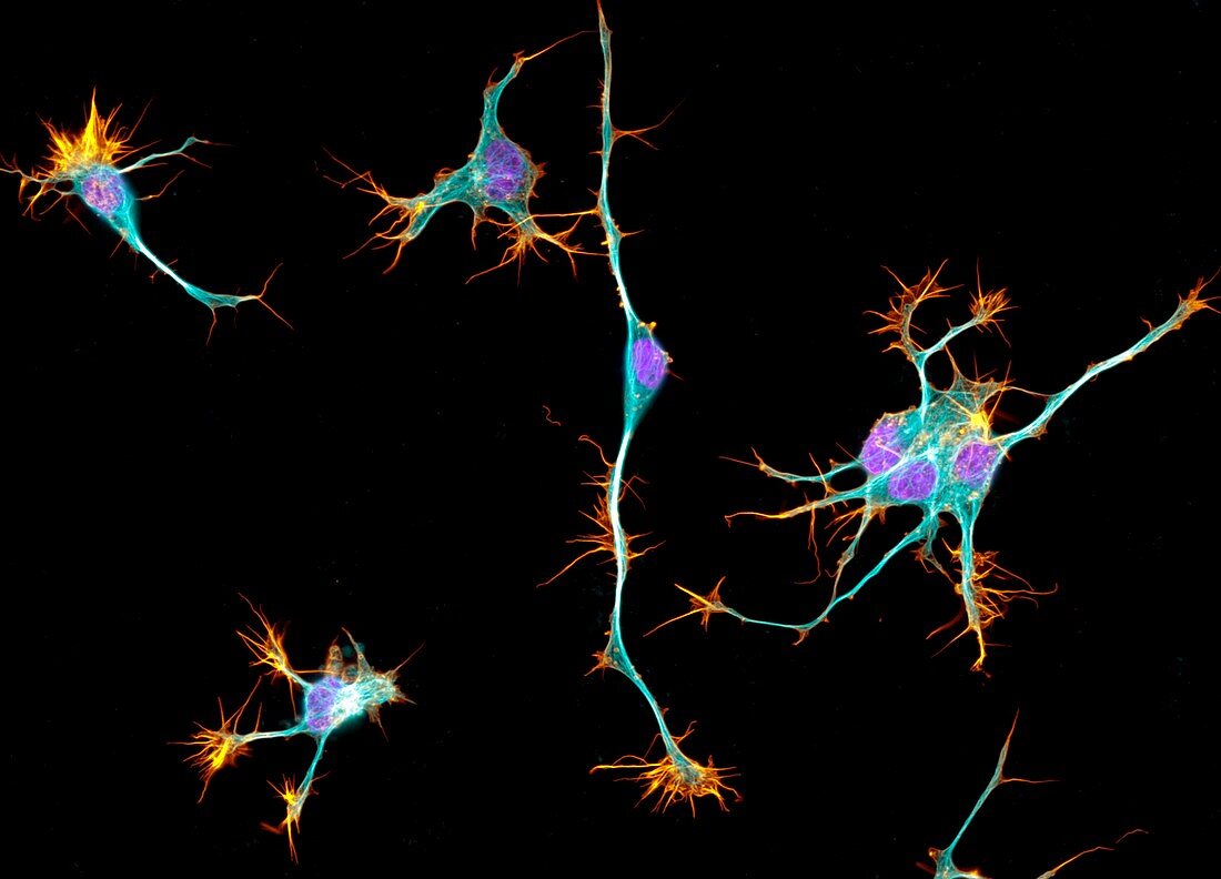 Neurons from stem cells,fluorescence light micrograph
