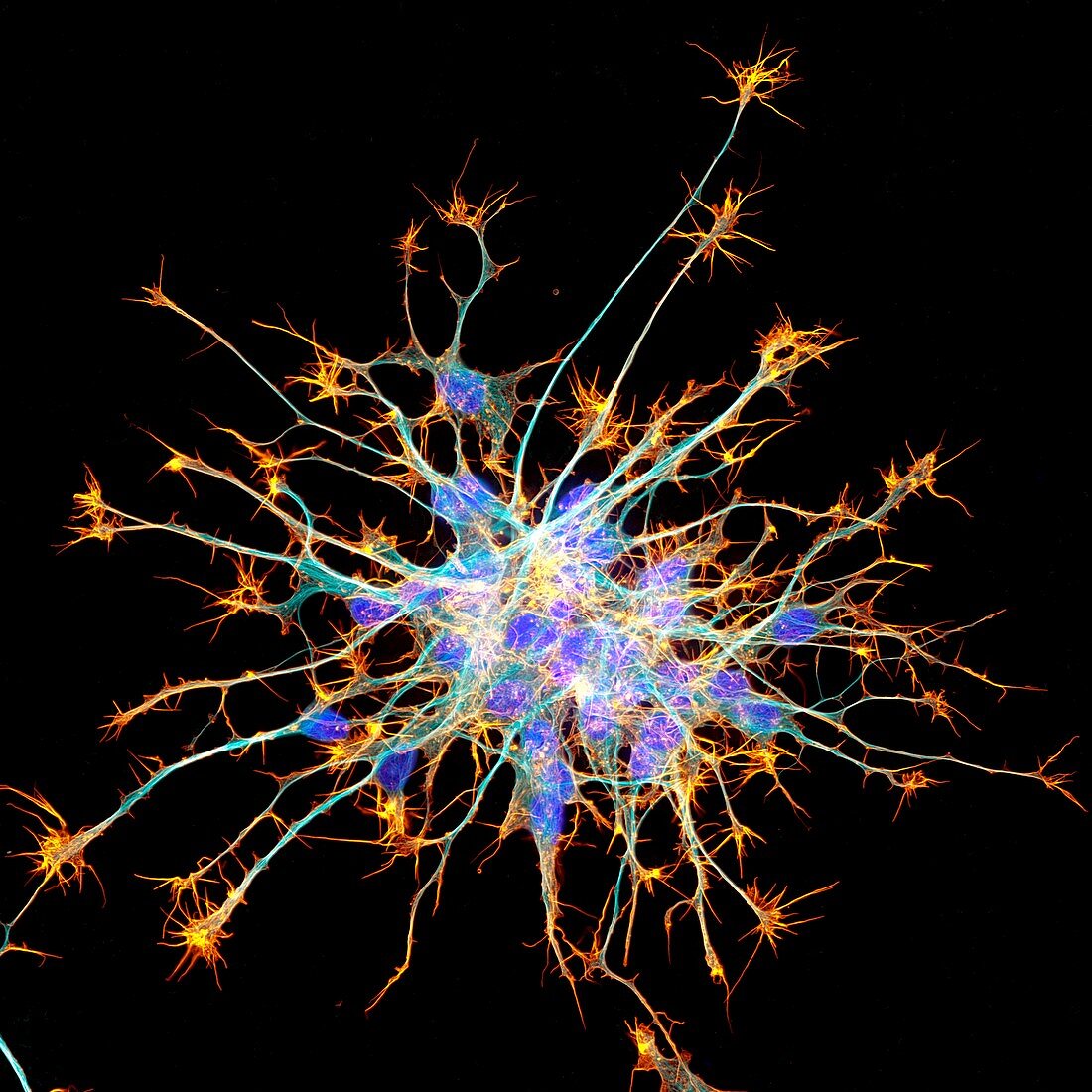 Neurons from stem cells,fluorescence light micrograph