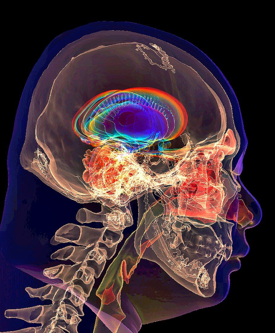 Human skull and limbic system,3D CT-based image