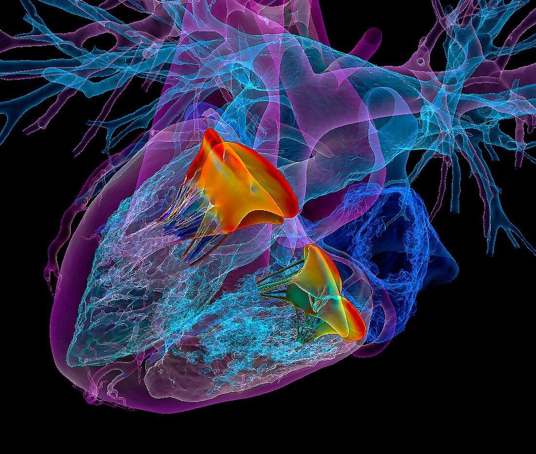 Heart and its valves,3D CT scan