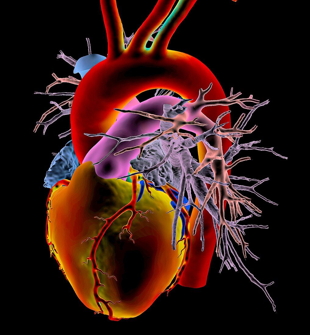 Human heart,3D CT scan
