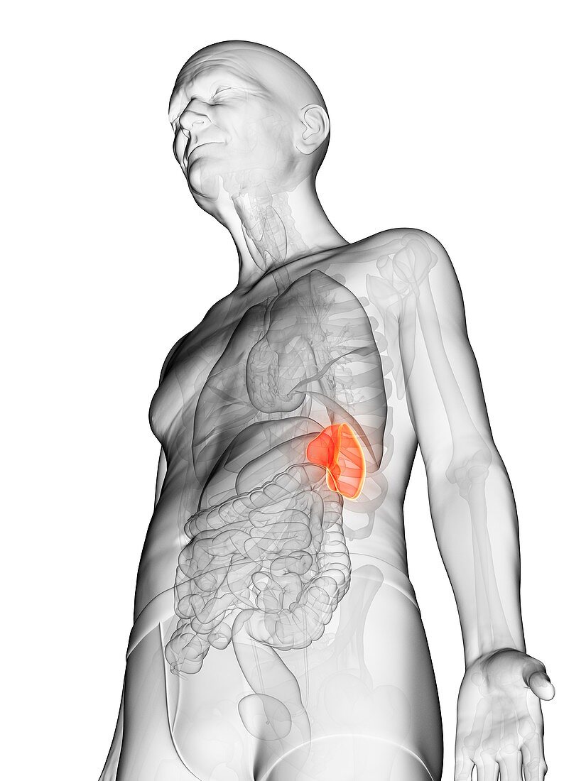 Illustration of an elderly man's spleen