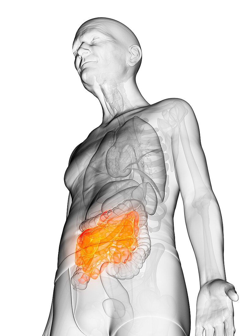 Illustration of an elderly man's small intestine