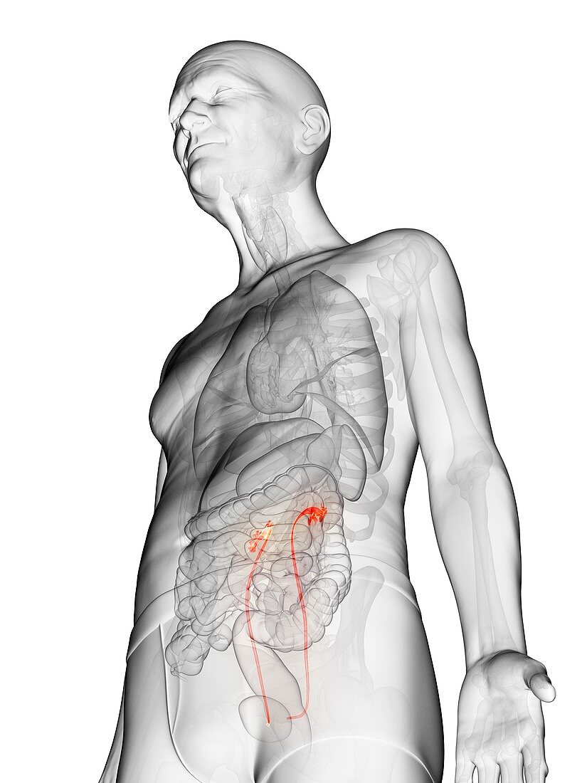 Illustration of an elderly man's ureters