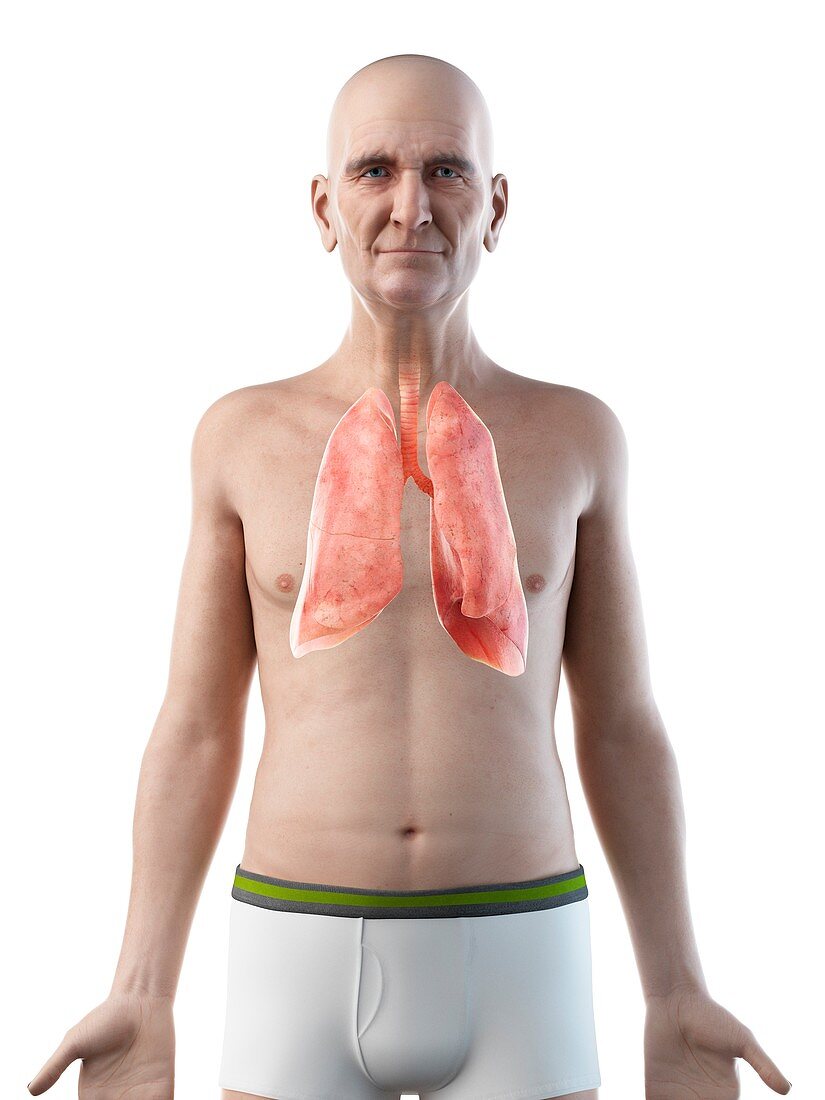 Illustration of an old man's lungs