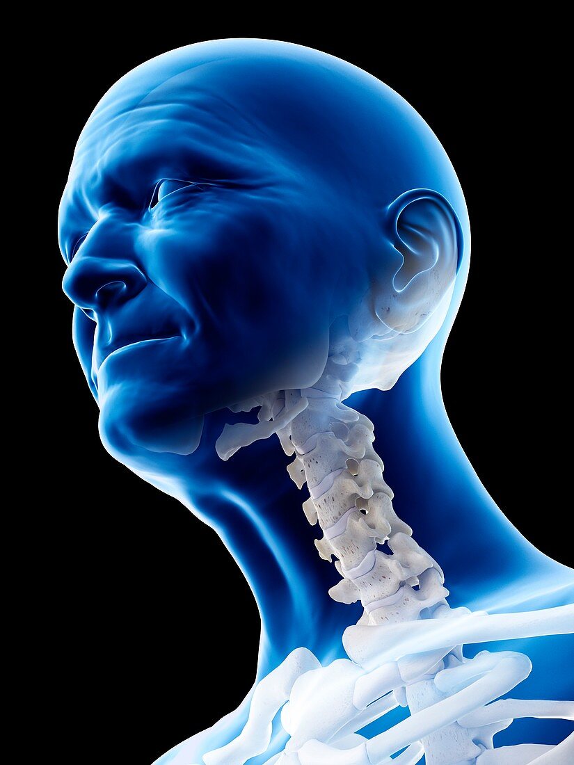 Illustration of an old man's cervical spine