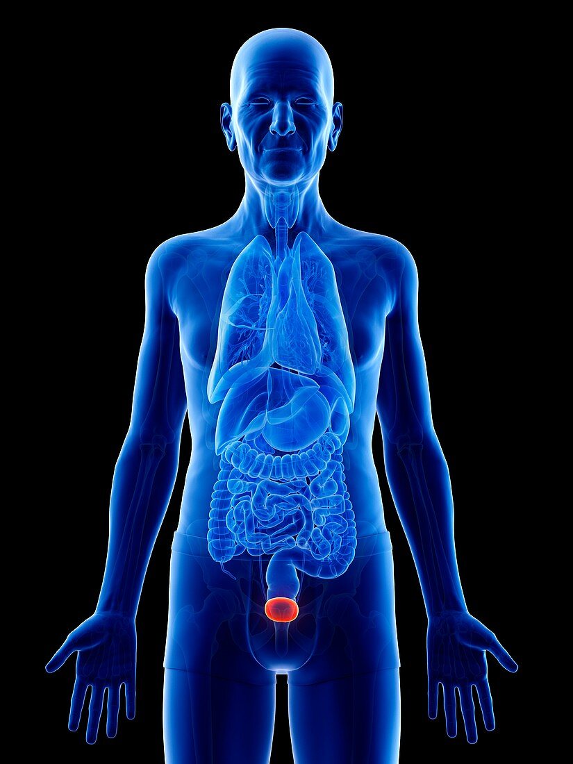 Illustration of an old man's urinary bladder