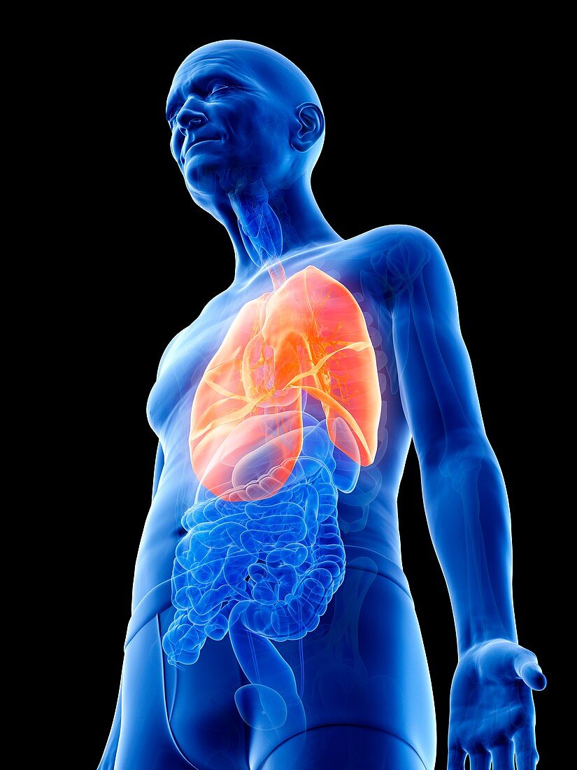 Illustration of an old man's lungs