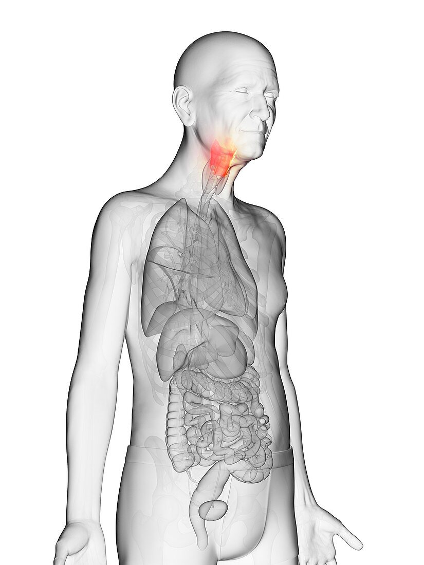 Illustration of an elderly man's larynx