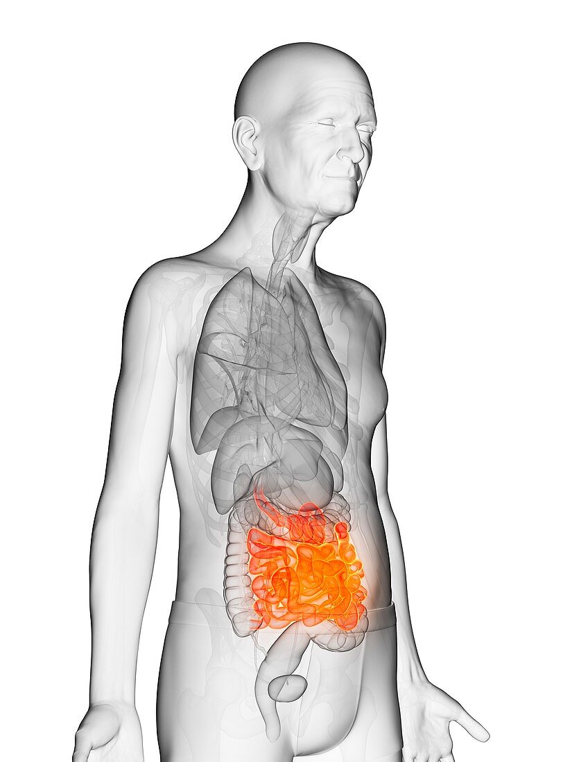 Illustration of an elderly man's small intestine