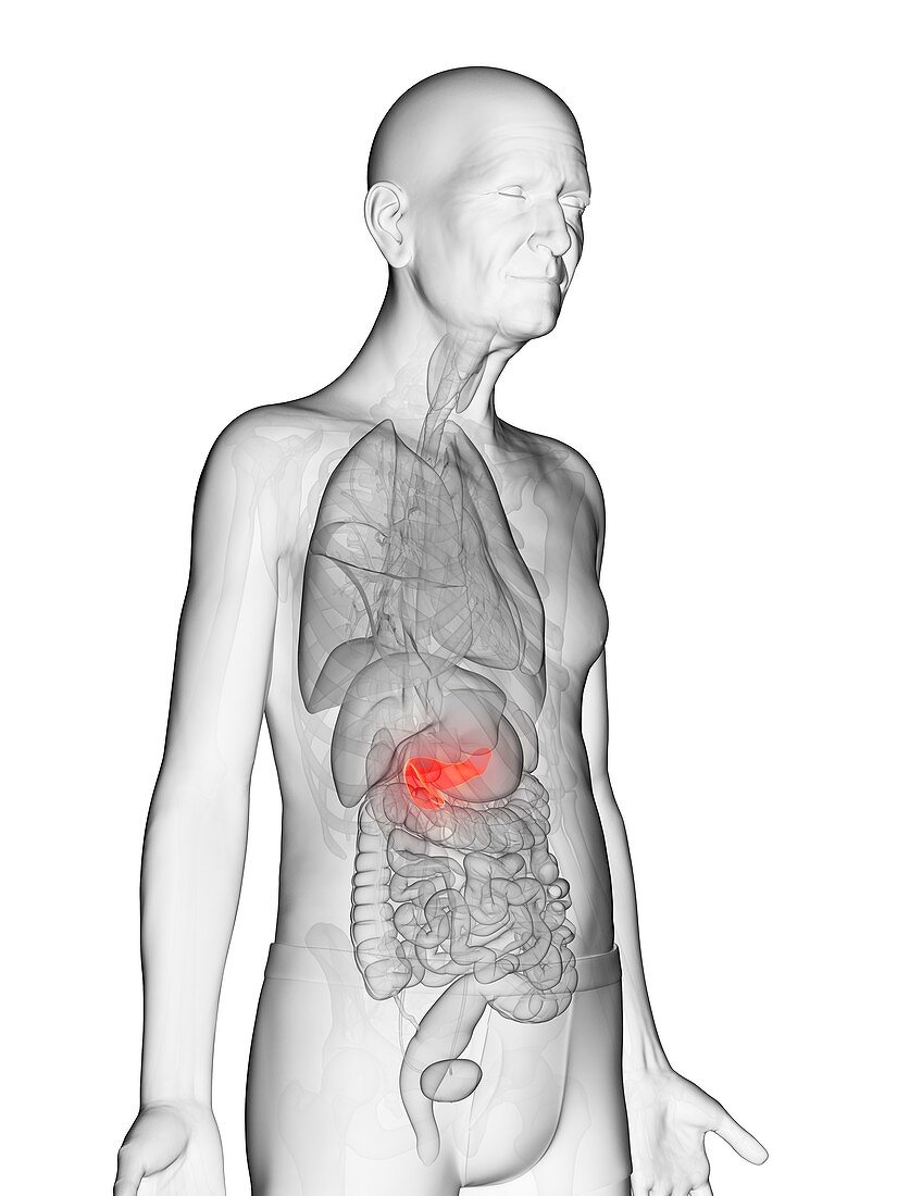 Illustration of an elderly man's pancreas
