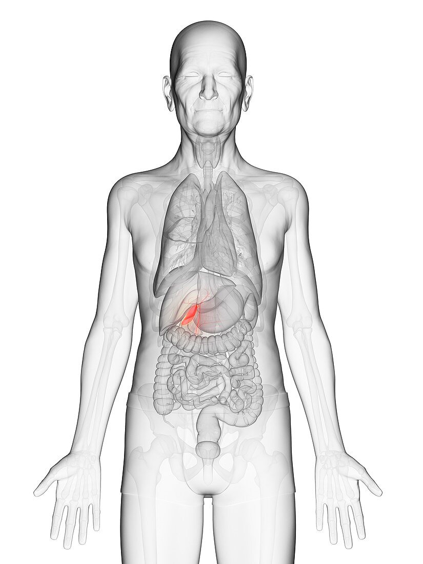 Illustration of an elderly man's gallbladder
