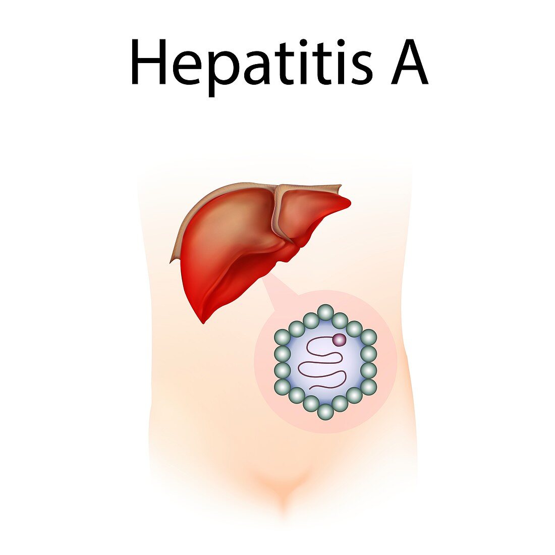 Hepatitis A,illustration