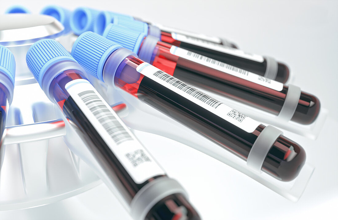 Centrifuging blood samples,illustration