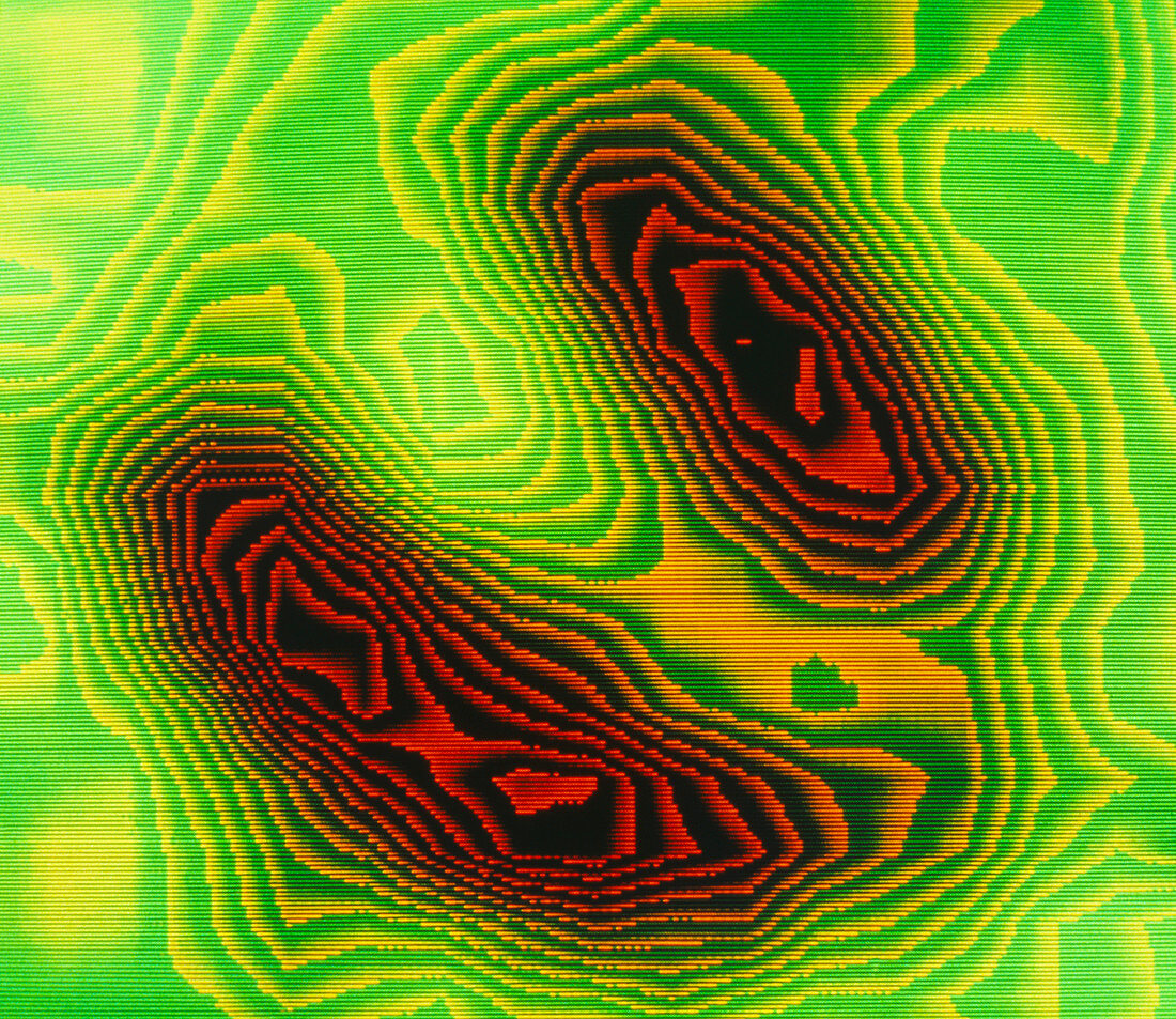 F/col gamma scan of post-infarction damaged heart