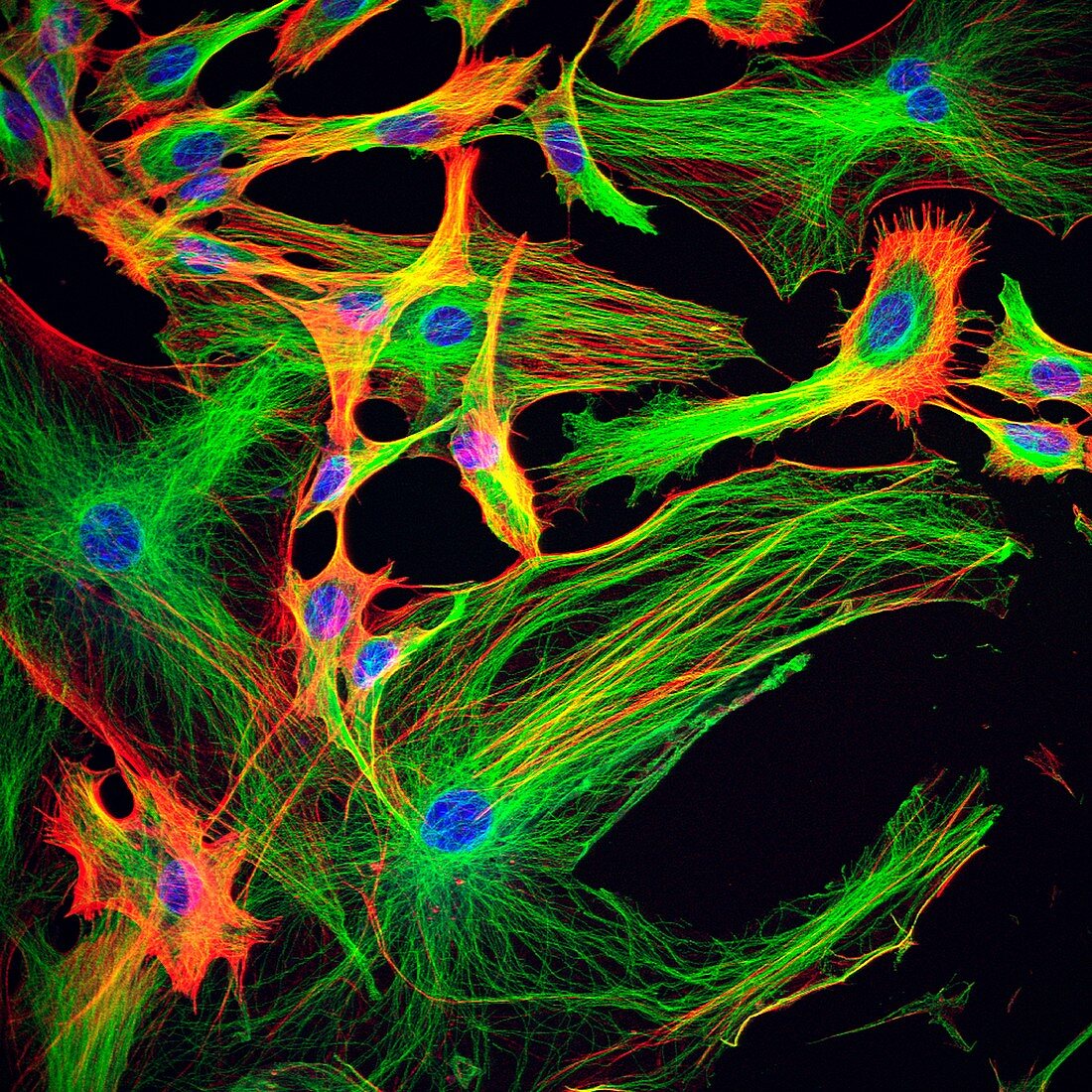 Astrocyte brain cells, confocal light micrograph