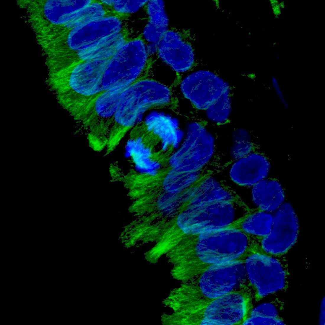 Mitosis, confocal light micrograph