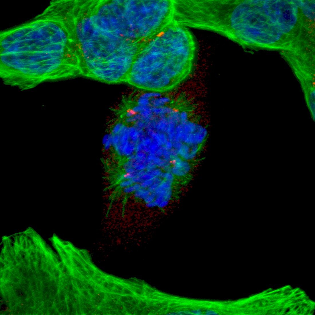Aberrant mitosis, confocal light micrograph