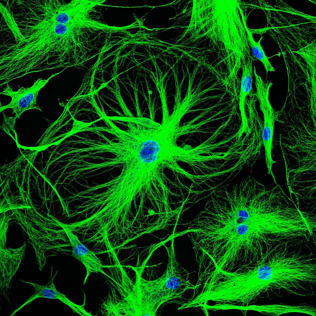 Astrocyte brain cells, confocal light micrograph