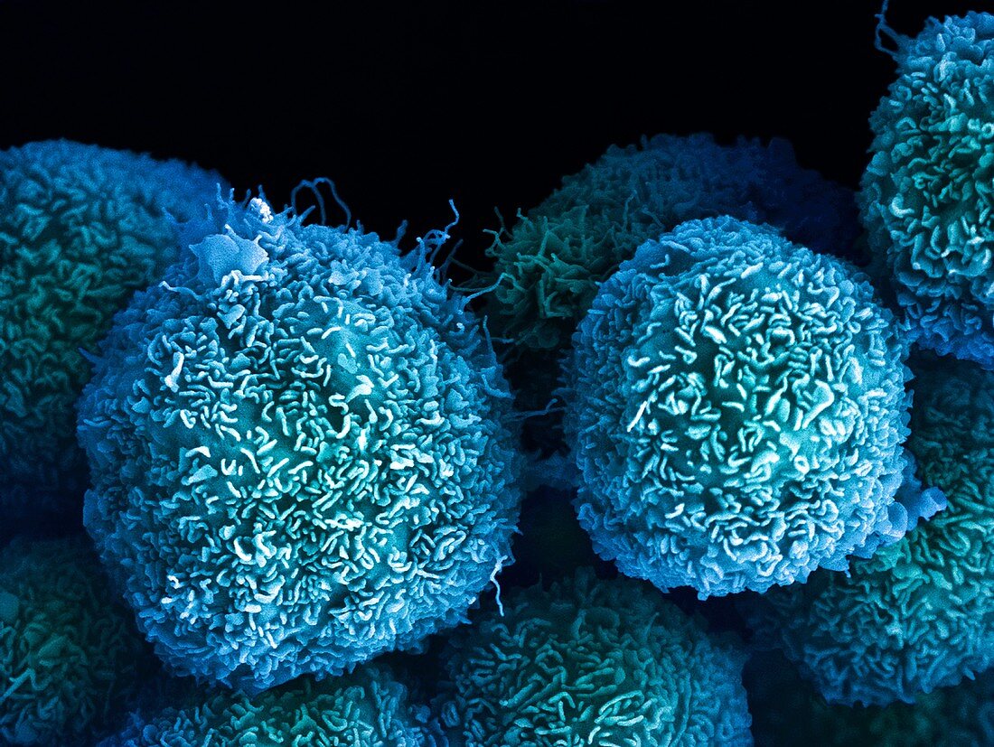 Pancreatic cancer cells, SEM