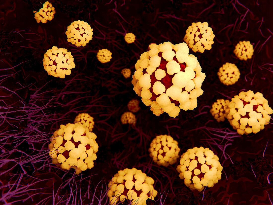 Coronavirus lung infection,illustration