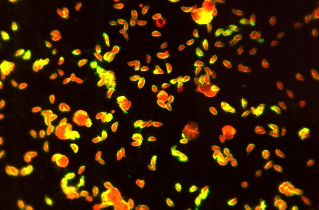 Toxoplasma gondii, fluorescence light micrograph