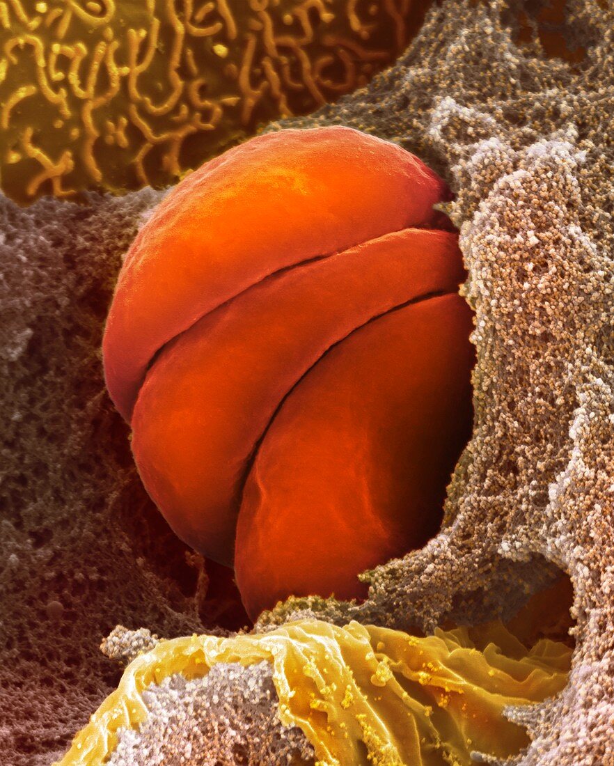 Human red blood cells in capillary, SEM