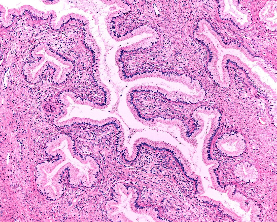 Endocervix tubular glands, light micrograph