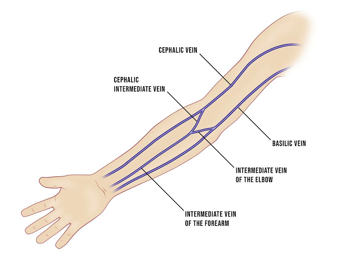 Venous cannulation sites in the arm, illustration