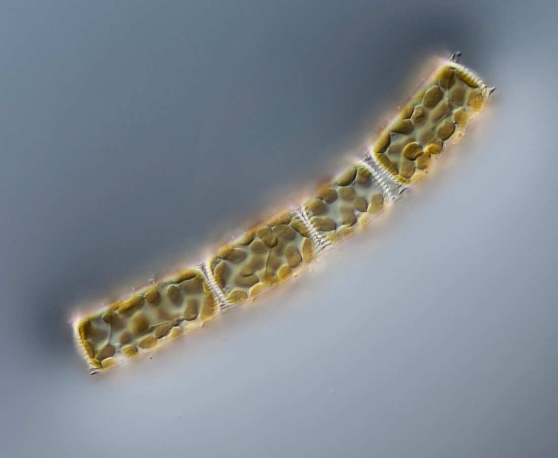 Melosira sp. diatoms, LM