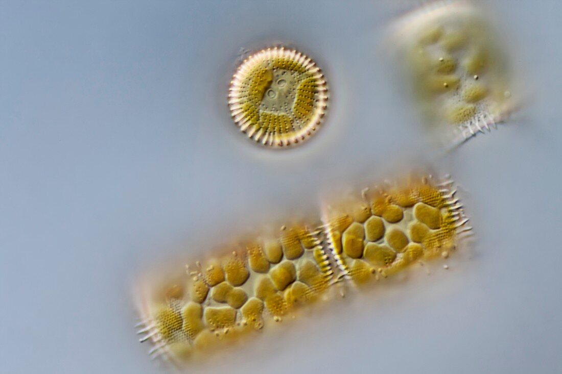 Melosira sp. diatoms, LM