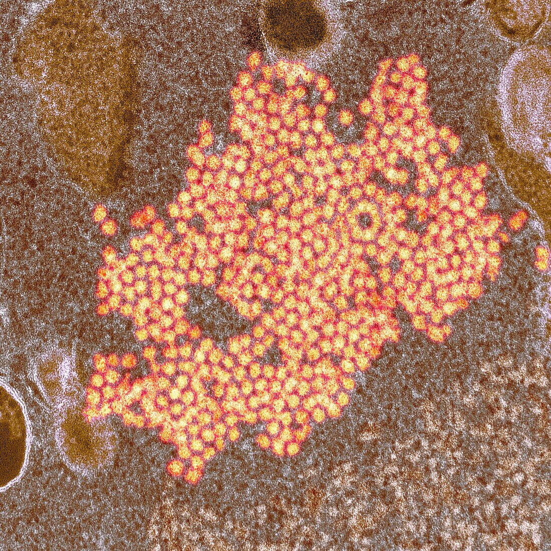 Enterovirus 68 virions, TEM